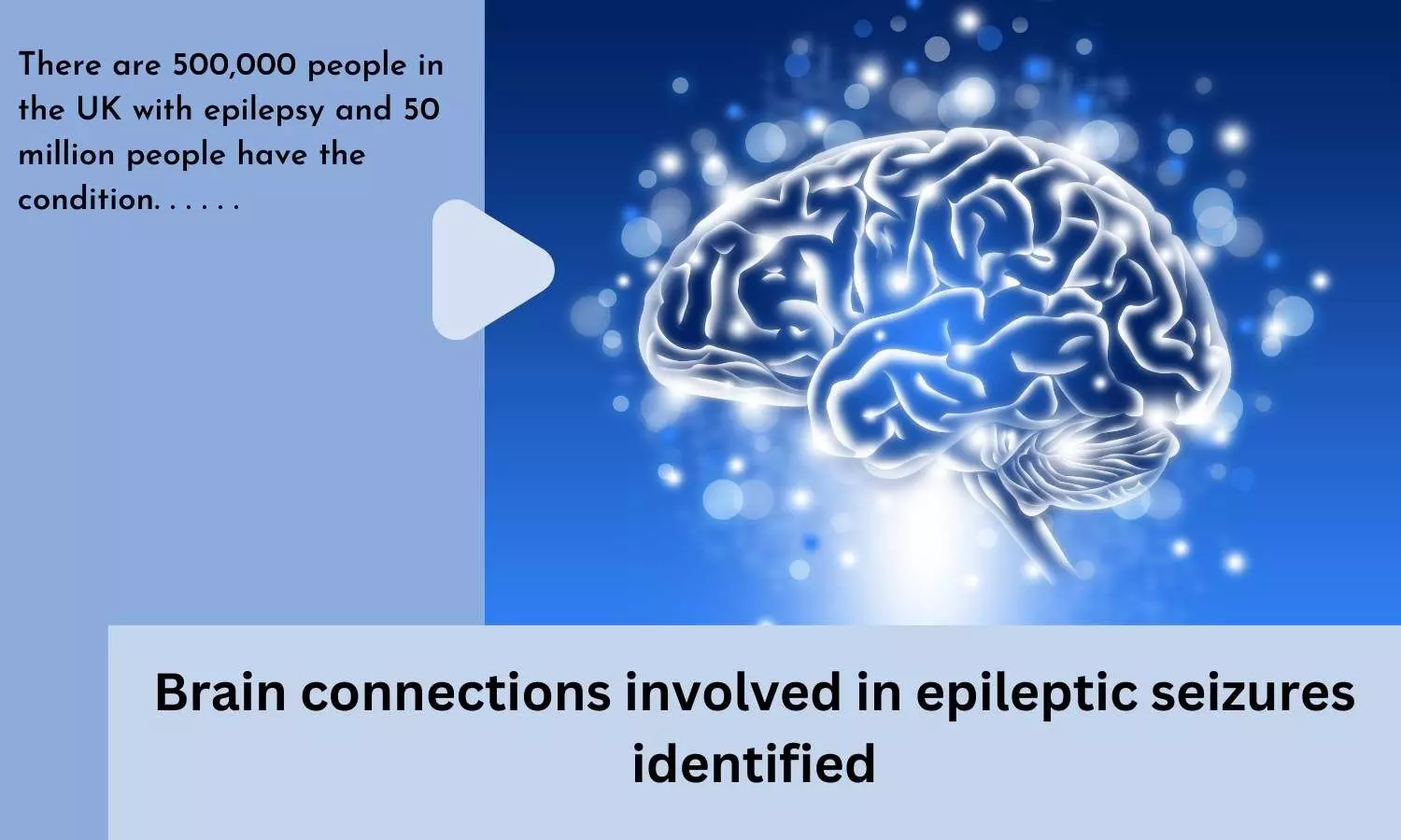 Brain connections involved in epileptic seizures identified