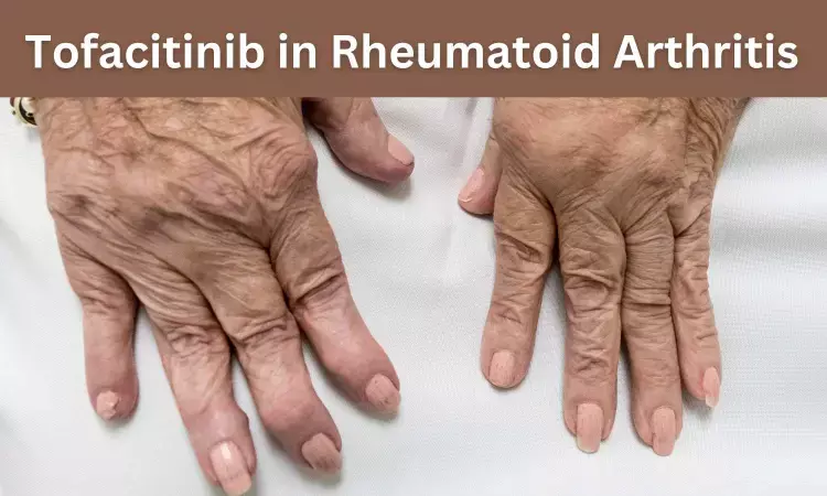 Decoding Safety and Efficacy of Generic Tofacitinib Tablets in Rheumatoid Arthritis: Indian Evidence