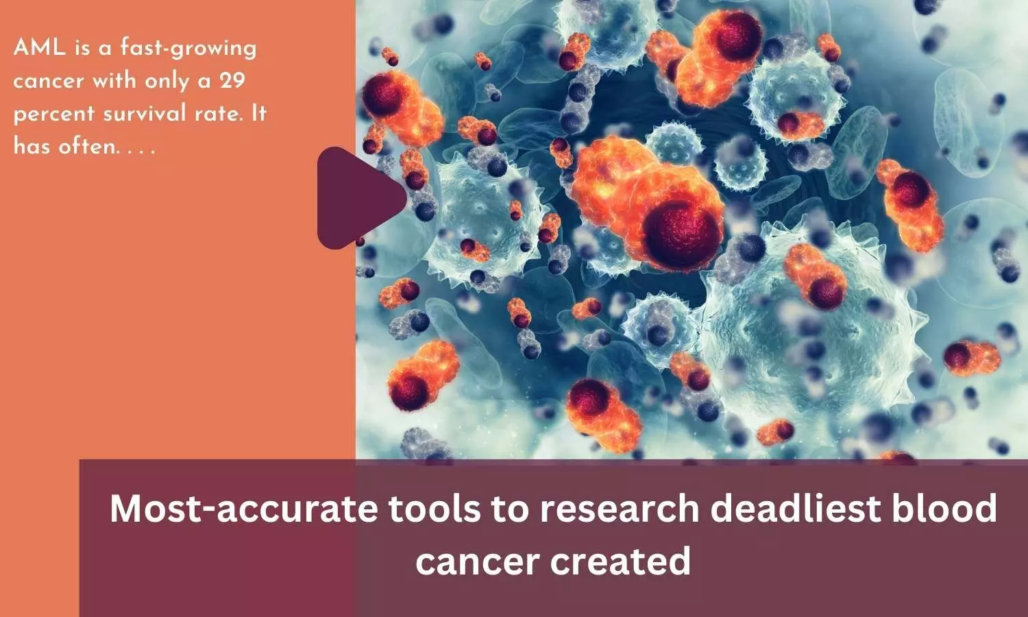 Most-accurate tools to research deadliest blood cancer created