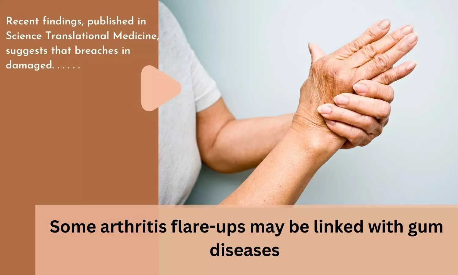 Some arthritis flare-ups may be linked with gum diseases