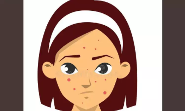 Preadolescents with higher socio-economic status present frequently with acne diagnosis