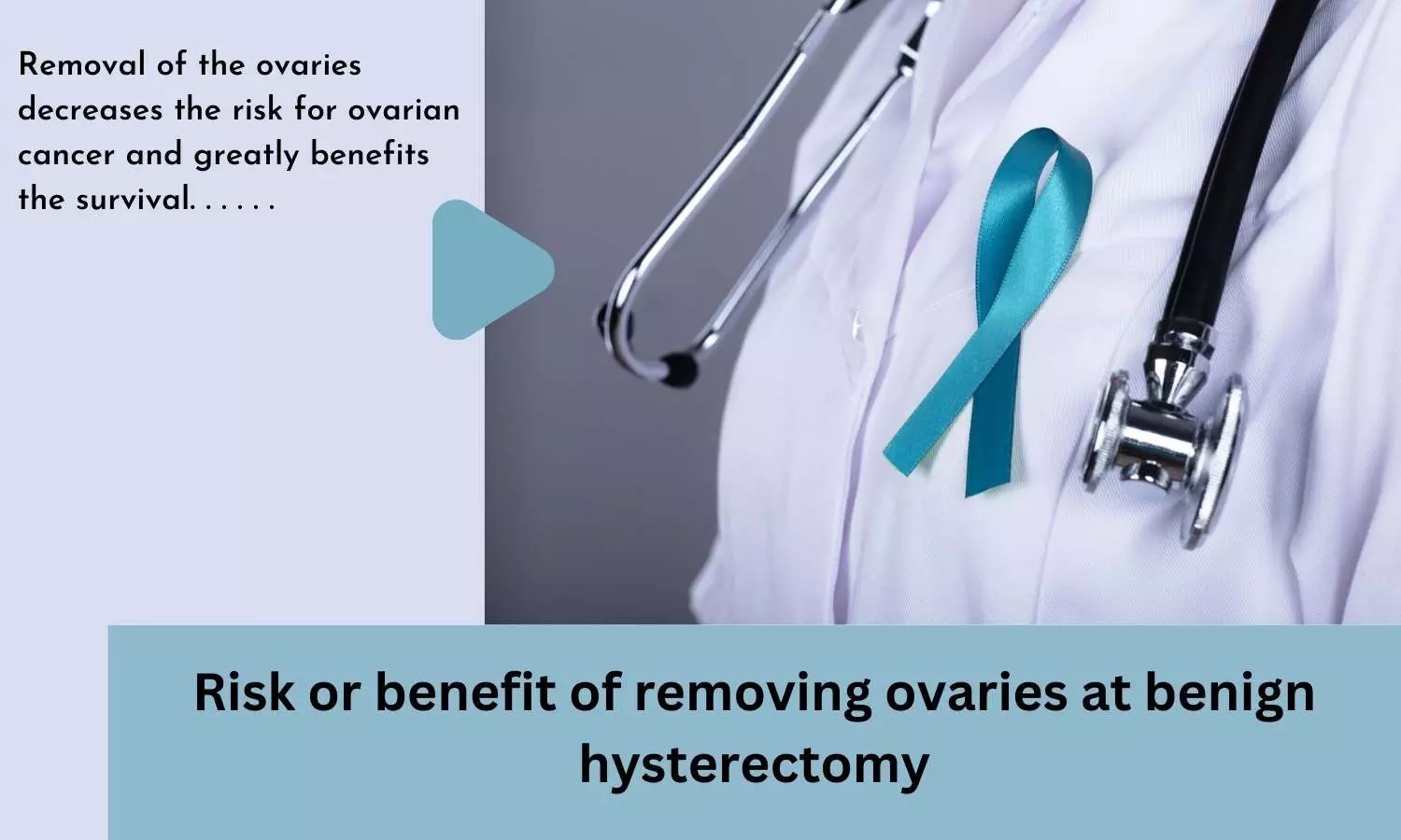 Risk or benefit of removing ovaries at benign hysterectomy
