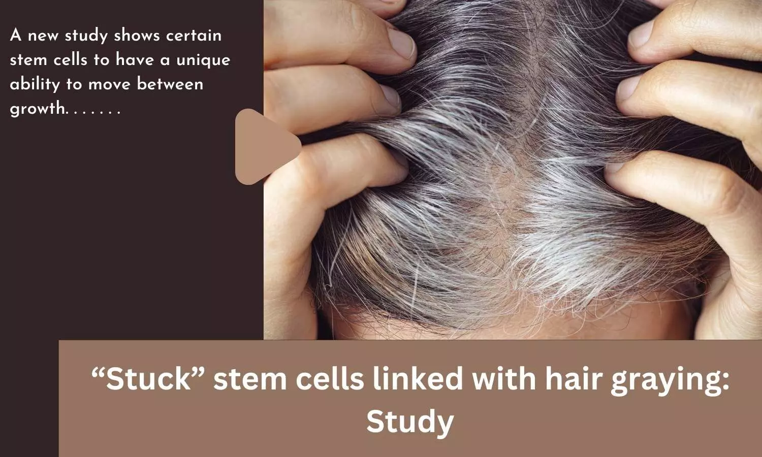 Stuck stem cells linked with hair graying: Study