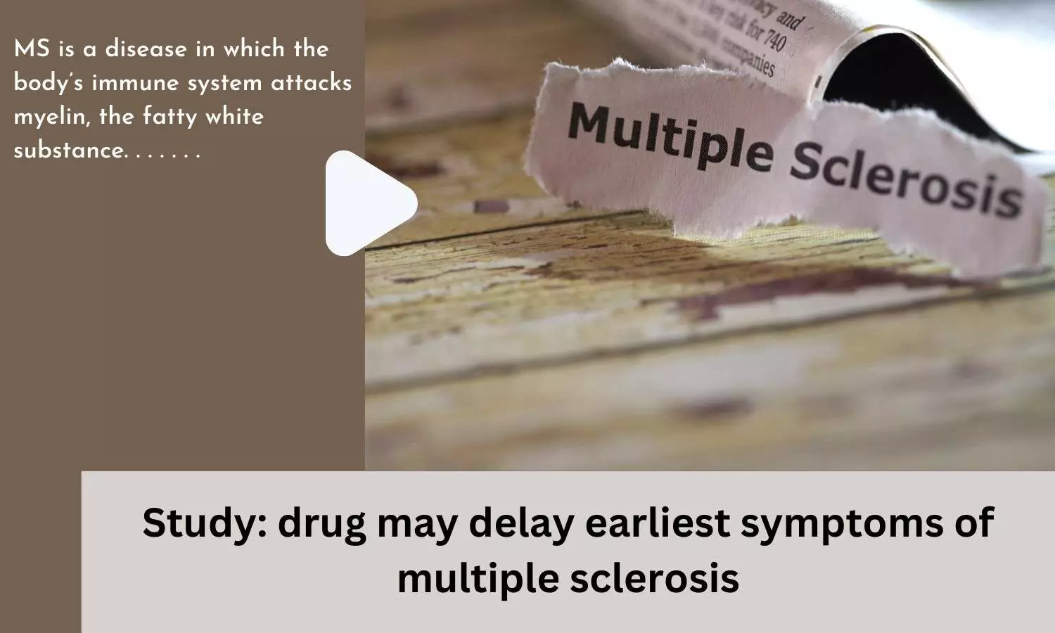 Study: drug may delay earliest symptoms of multiple sclerosis