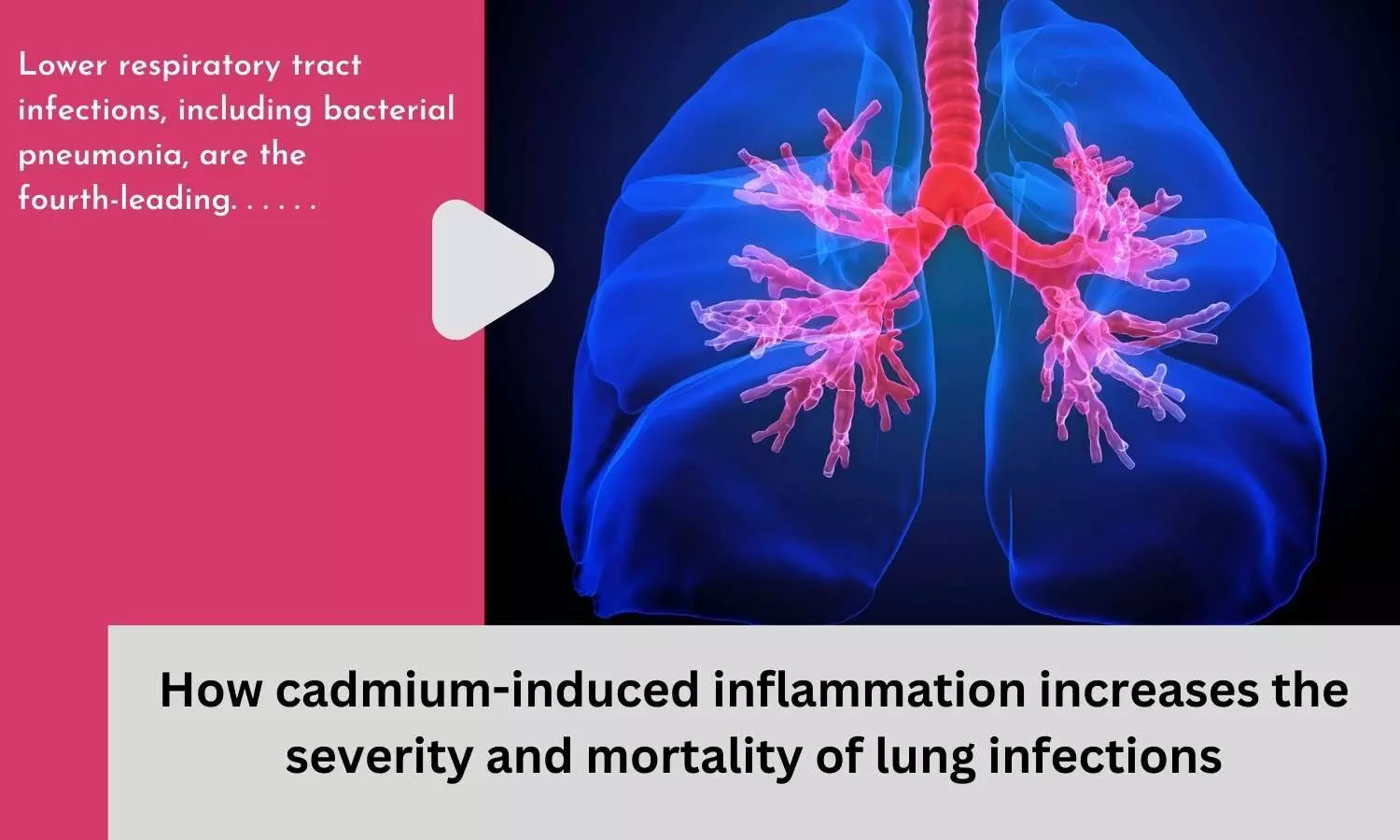 How cadmium-induced inflammation increases the severity and mortality of lung infections