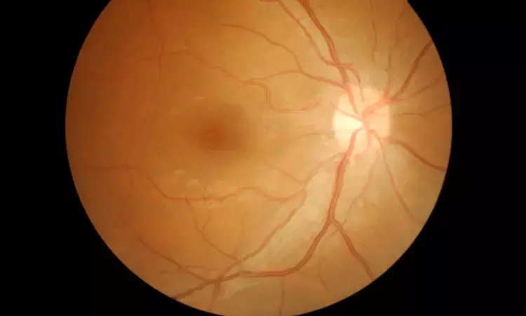 Razumab both safe and cost-effective for managing retinopathy by prematurity