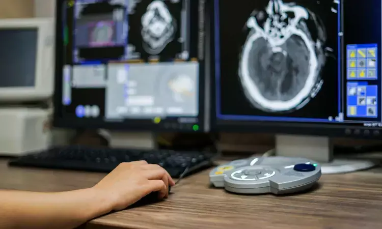 Exposure to single CT scan in children tied to low cancers risk, but four or more CTs double risk