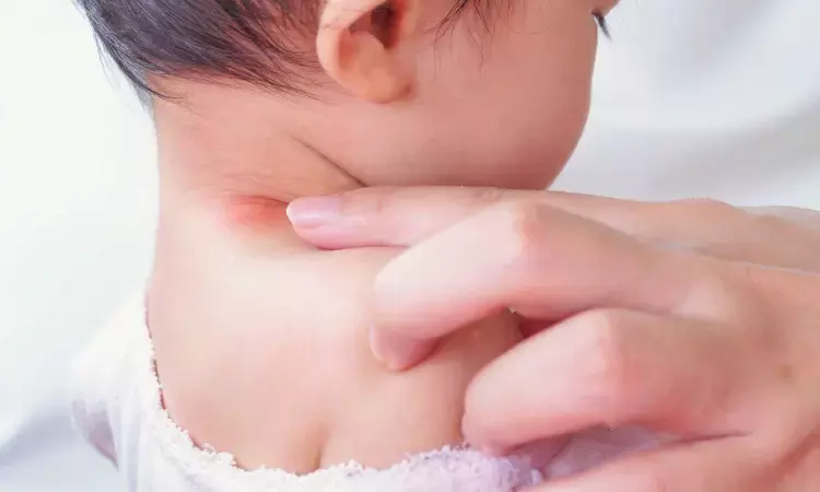 Green living environment in early childhood does not protect against eczema