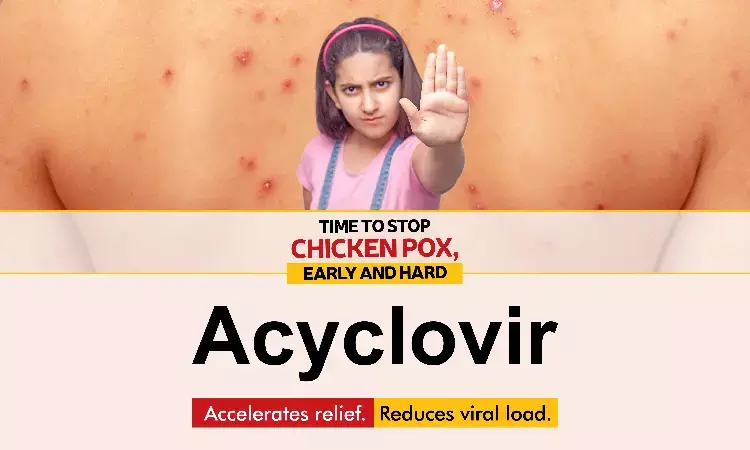 Role of acyclovir in Management of chickenpox: Analyzing the importance of starting early