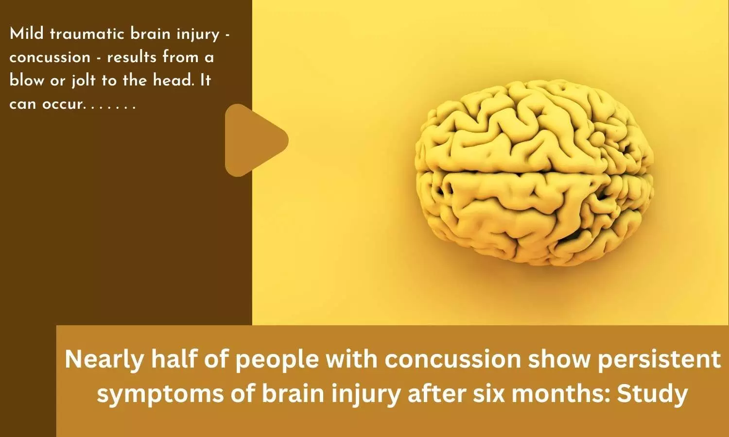 Nearly half of people with concussion show persistent symptoms of brain injury after six months: Study