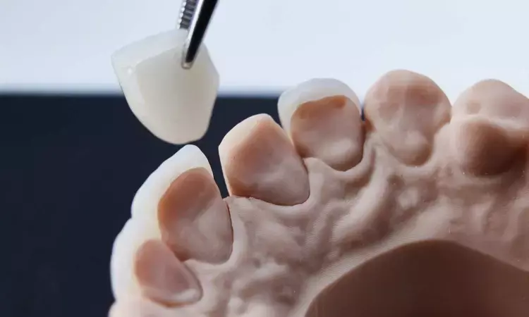 AI may help design dental crowns based on a valid 3D deep learning algorithm