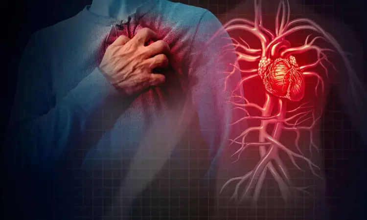 AI-based algorithm can diagnose heart attacks with better accuracy and speed