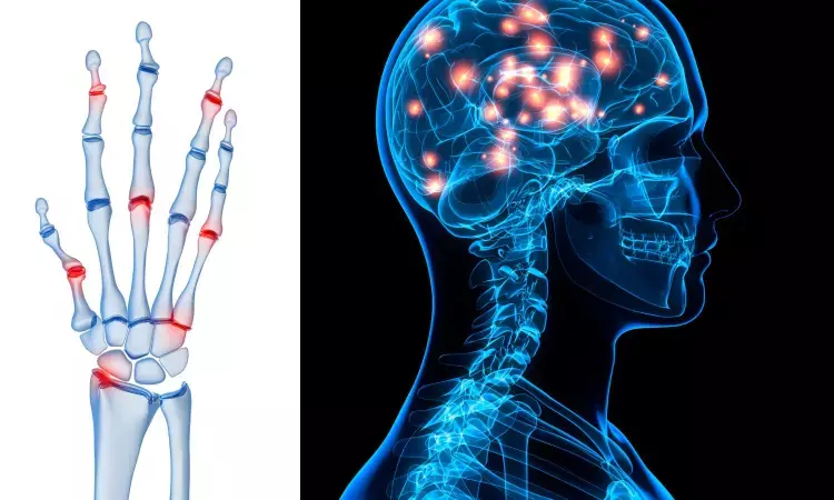 Rheumatoid arthritis increases risk of Parkinsons disease by 1.74 folds