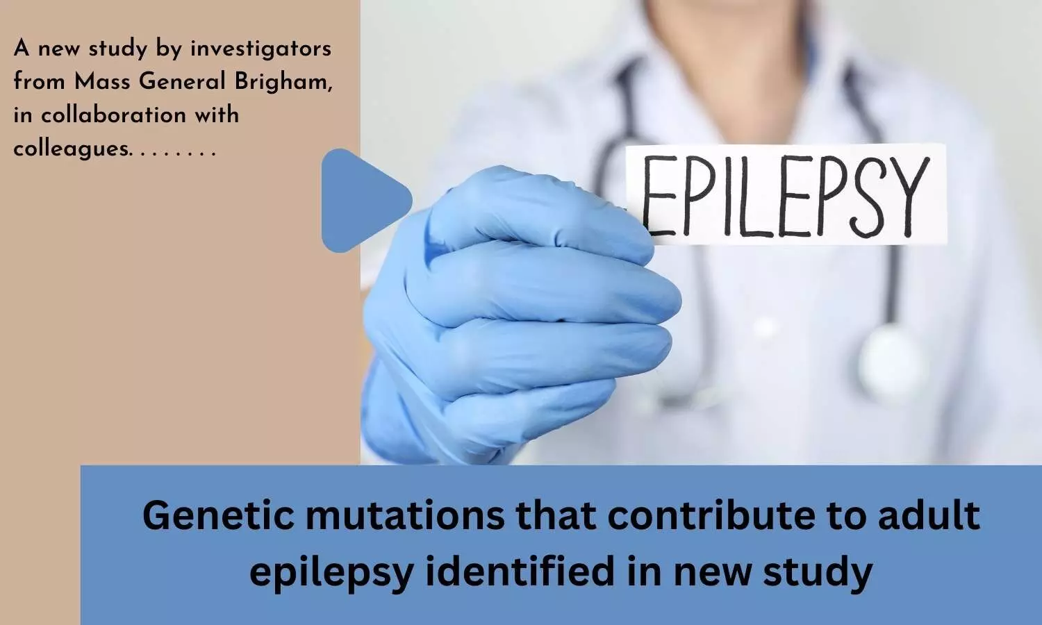 Genetic mutations that contribute to adult epilepsy identified in new study