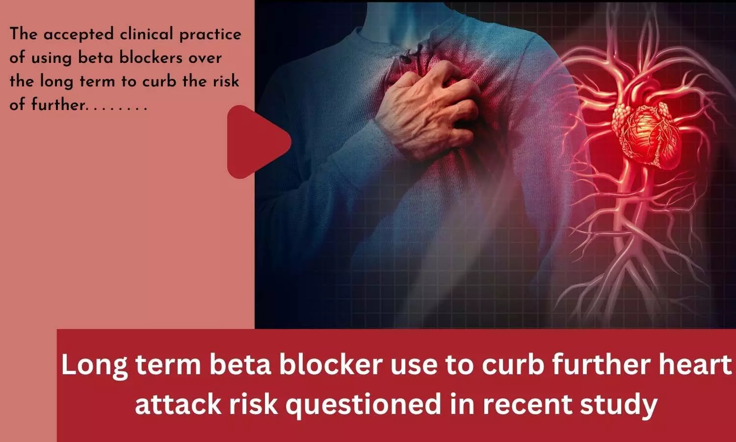 Long term beta blocker use to curb further heart attack risk questioned in recent study