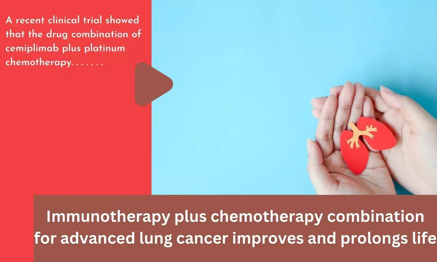 Immunotherapy plus chemotherapy combination for advanced lung cancer improves and prolongs life