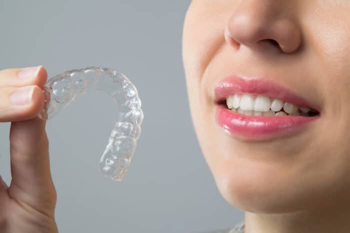 Clear Aligners Improve Oral Microbiological and Periodontal Health Over Fixed Appliances: Study