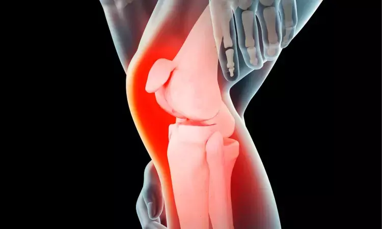 Outpatient and Inpatient Fast-Track Knee Arthroplasty Show Similar Complication Rates, unravels study