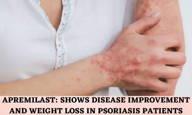 Apremilast lowers weight and improves obese patients with psoriasis and psoriatic arthritis