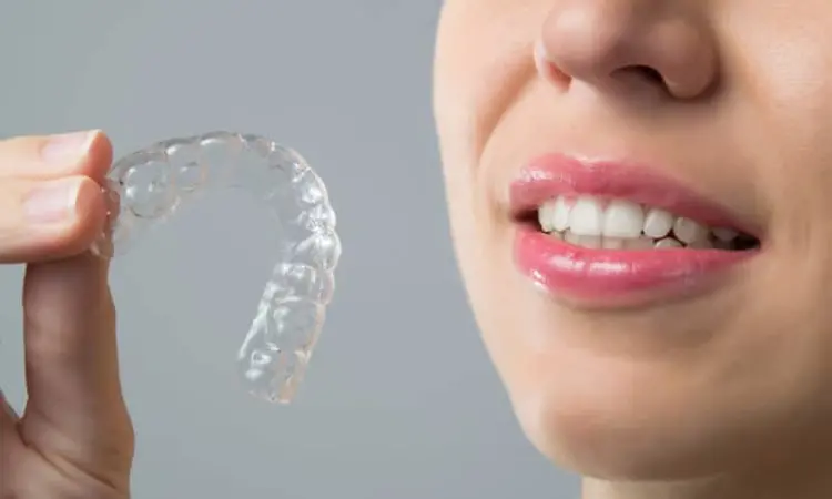 Patients using Invisalign may need 2-3 refinement scans and short duration of braces