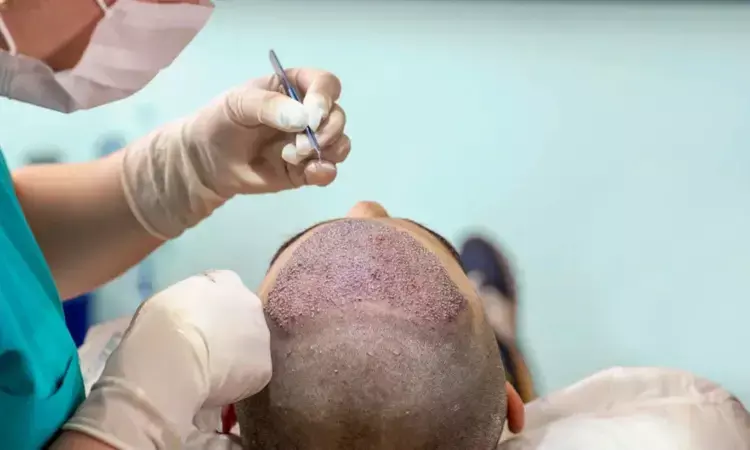 Stabilized super-oxidized hypochlorous acid spray may expedite healing in patients undergoing hair restoration surgery