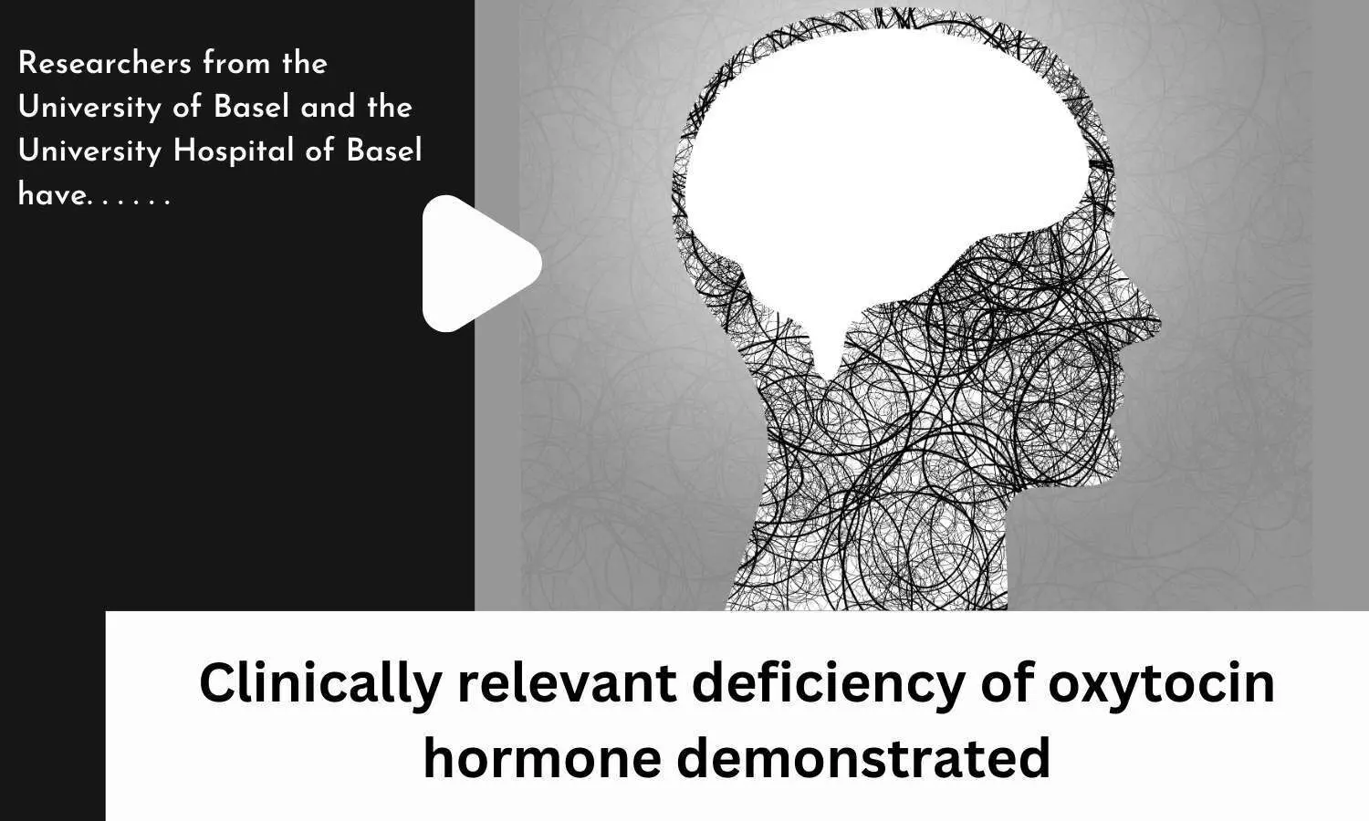 Clinically relevant deficiency of oxytocin hormone demonstrated