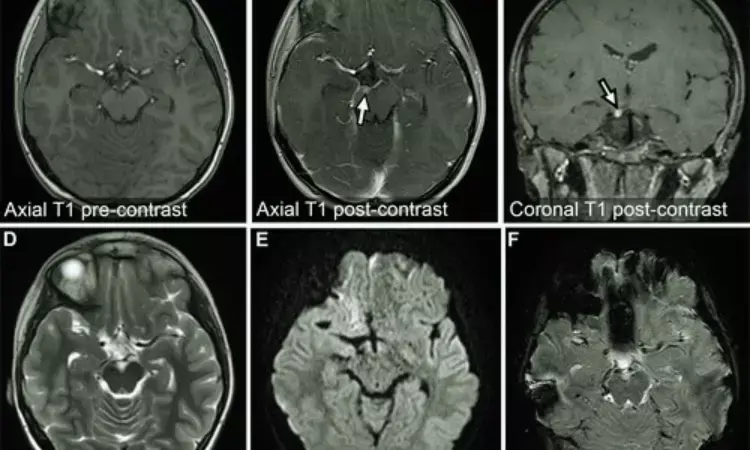 FAST MRI effective for diagnosing emergency conditions: Study