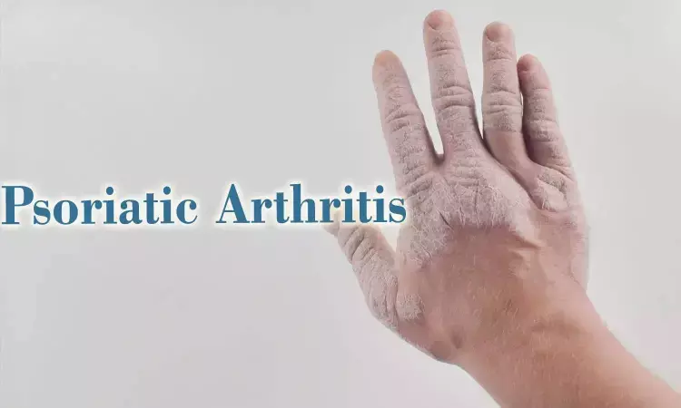 Brepocitinib Shows Promise for Treatment of Psoriatic Arthritis