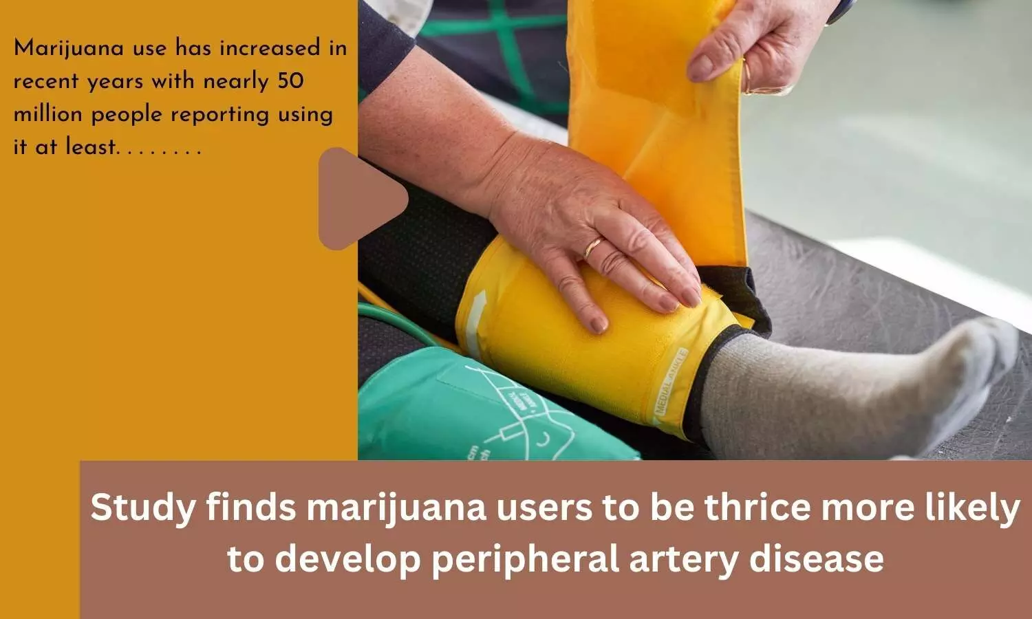 Study finds marijuana users to be thrice more likely to develop peripheral artery disease