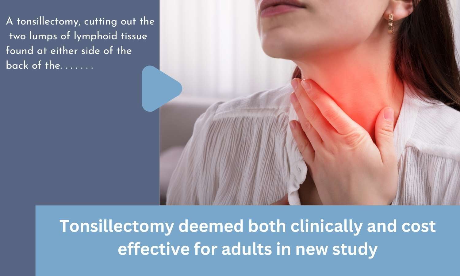 Tonsillectomy deemed both clinically and cost effective for adults in