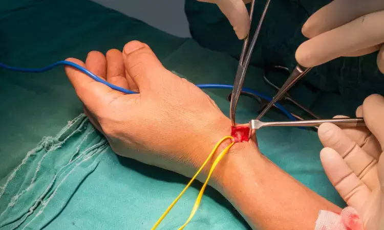 Radial arterial access superior to femoral access in PCI: Study
