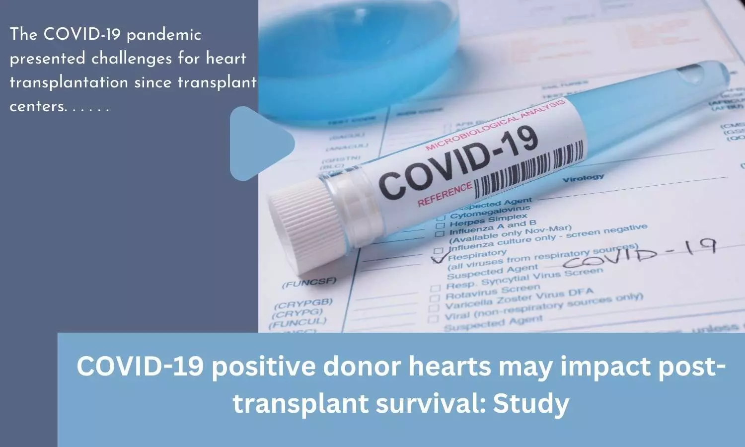 COVID-19 positive donor hearts may impact post-transplant survival: Study
