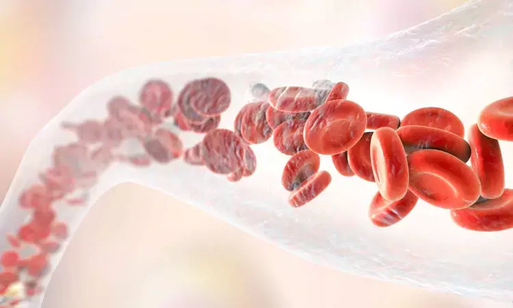 Long term use of blood thinners promising in reducing complications for patients following MI
