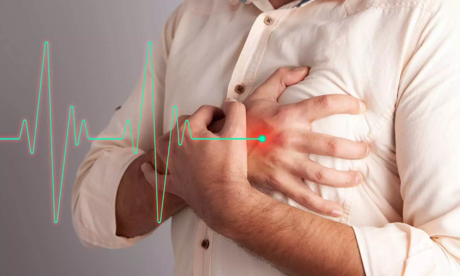 Management of Heart Failure: ESC Updates Guidelines