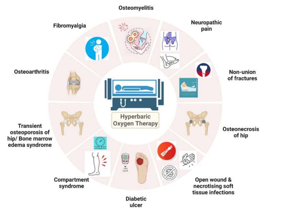 Hyperbaric Oxygen Therapy as adjunct has emerging role in Orthopaedics