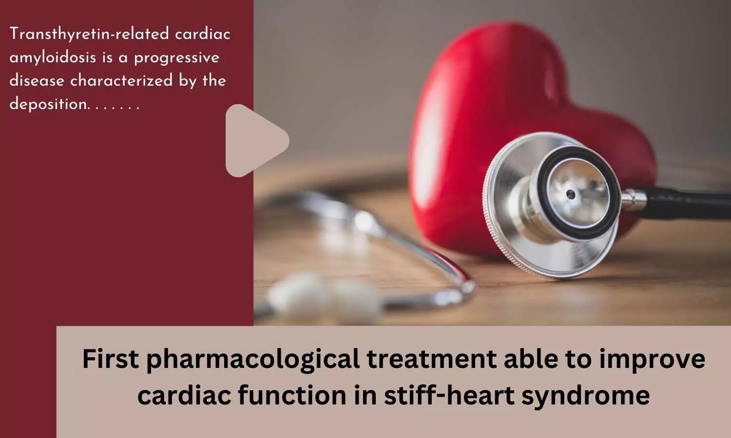First pharmacological treatment able to improve cardiac function in stiff-heart syndrome