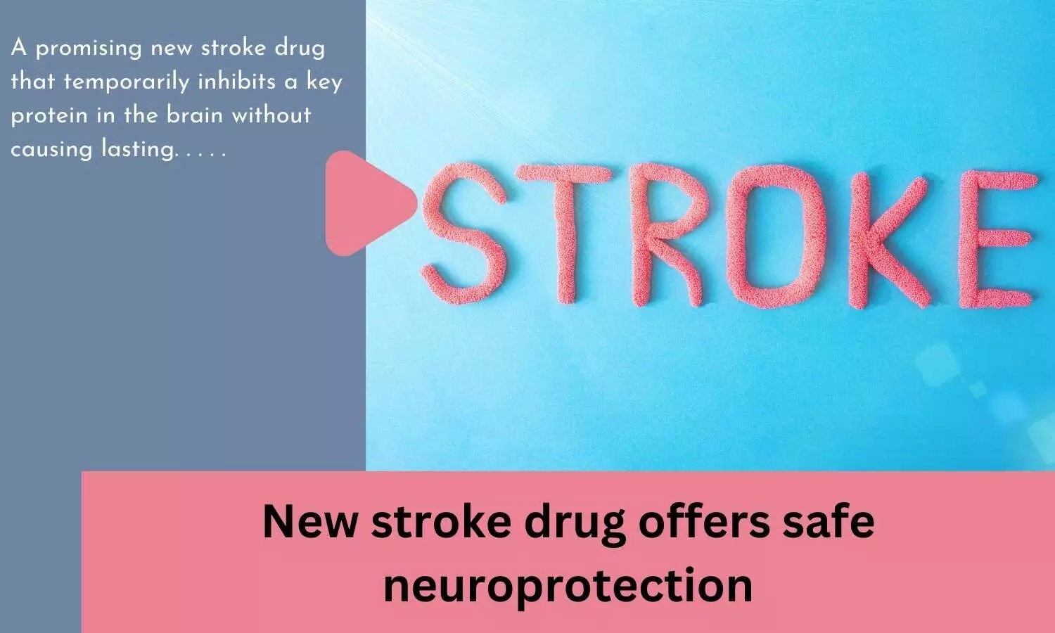 New stroke drug offers safe neuroprotection