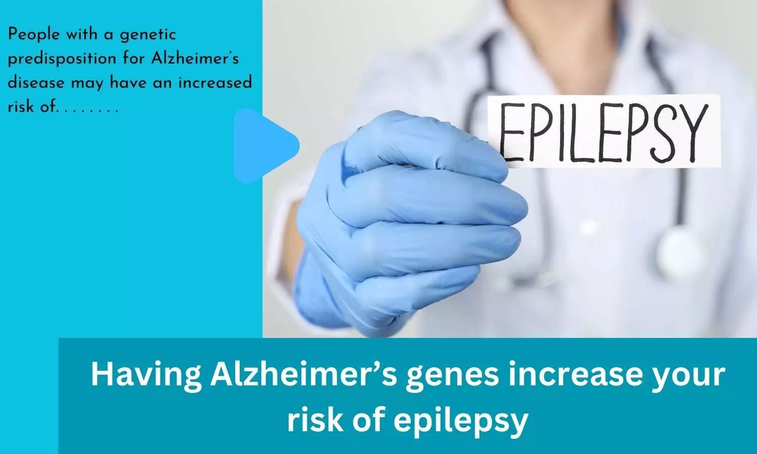 Having Alzheimers genes increase your risk of epilepsy