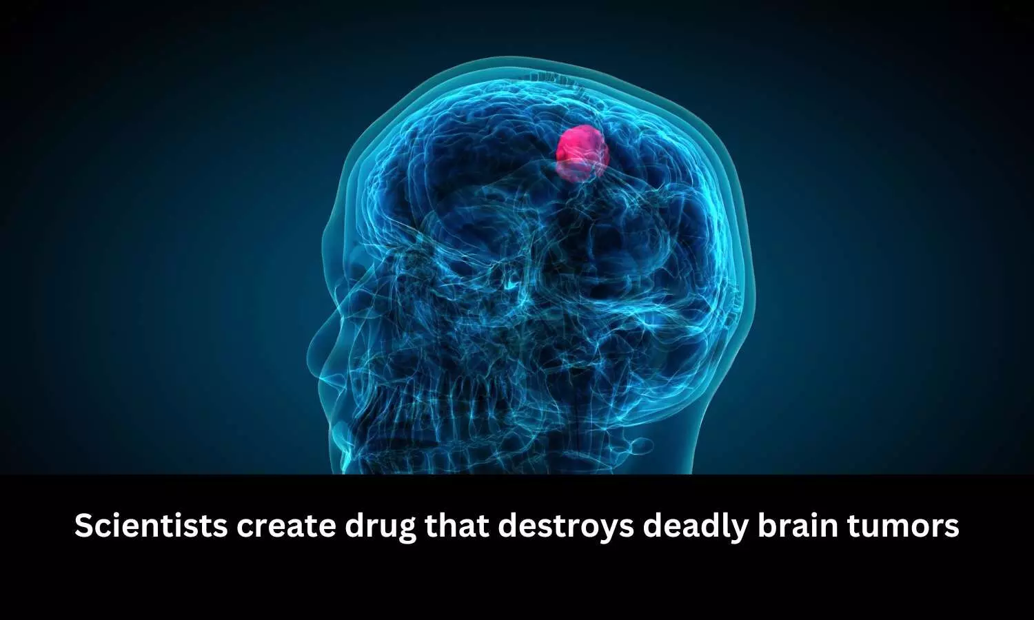 Scientists create drug that destroys deadly brain tumors