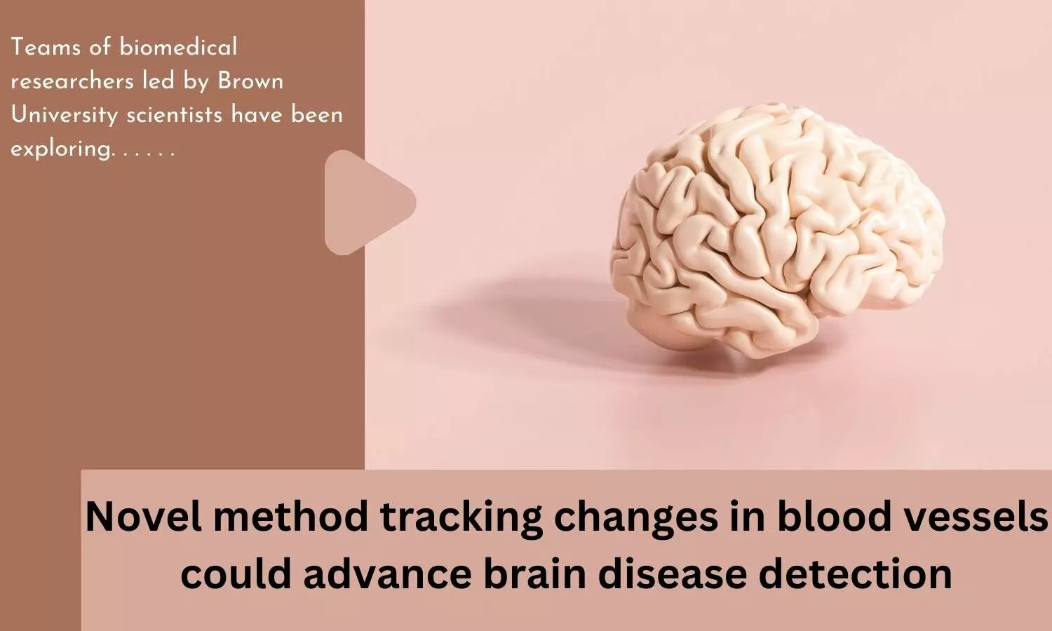 Novel method tracking changes in blood vessels could advance brain disease detection