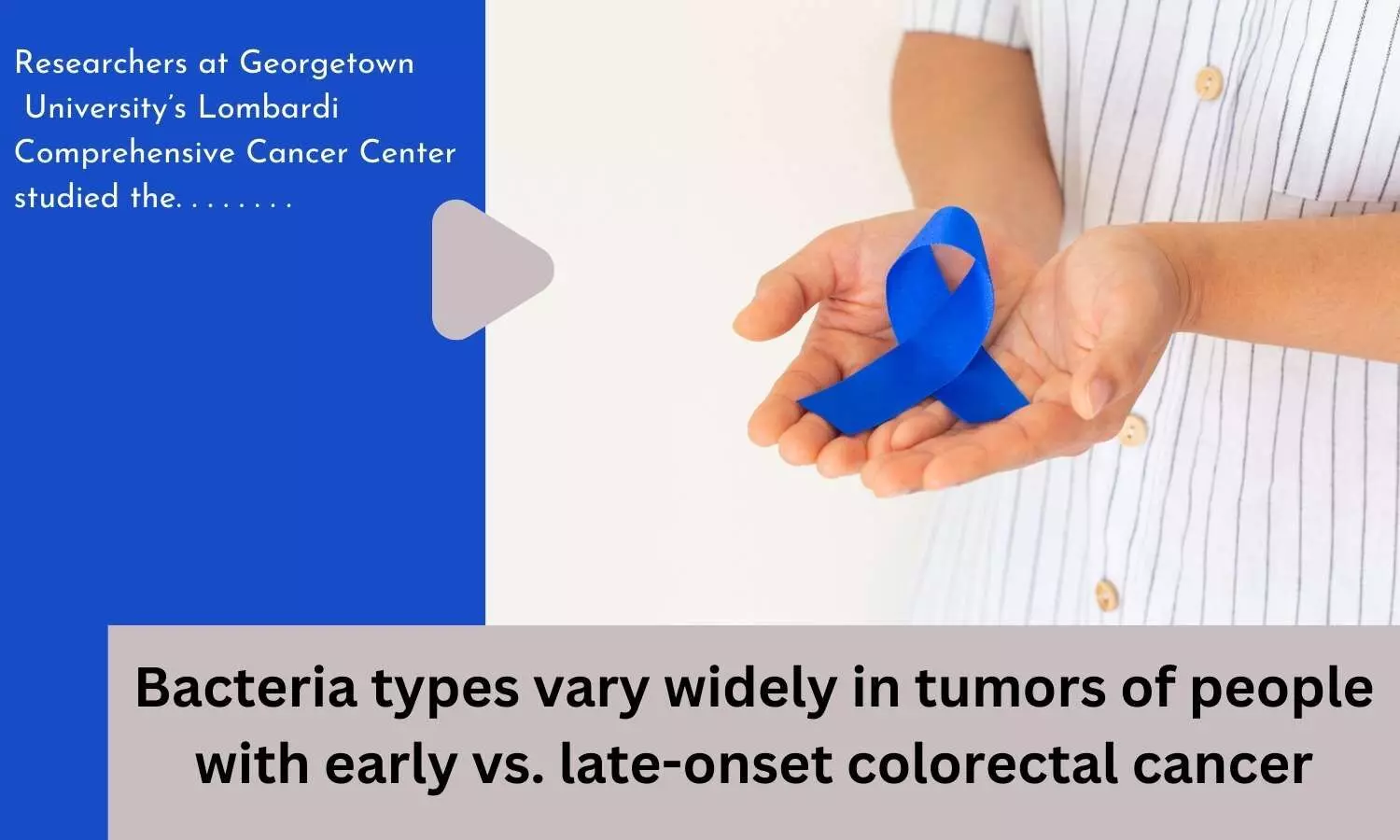 Bacteria types vary widely in tumors of people with early vs. late-onset colorectal cancer