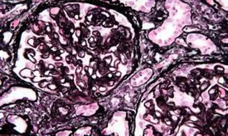 DMSA-induced membranous nephropathy in a patient with Wilsons disease: Case report