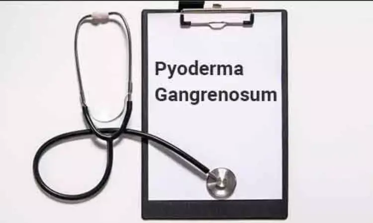 JAK inhibitors feasible treatment option for patients with Pyoderma gangrenosum