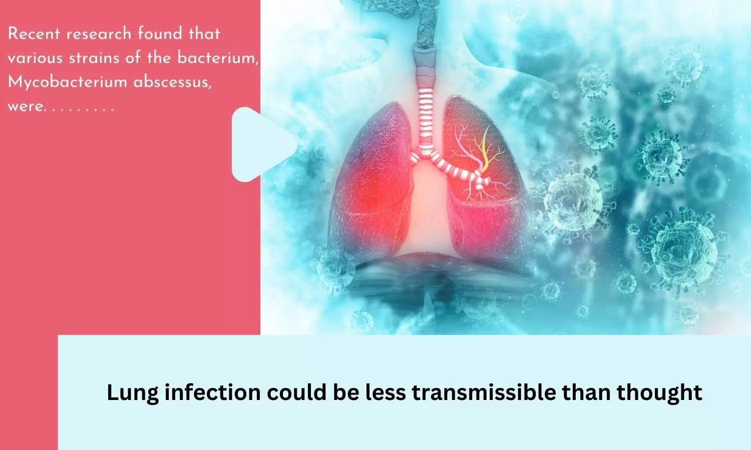 Lung infection could be less transmissible than thought
