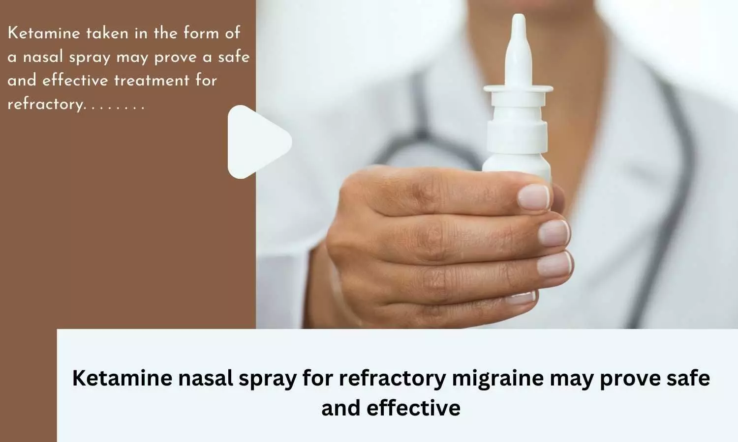 Ketamine nasal spray for refractory migraine may prove safe and effective