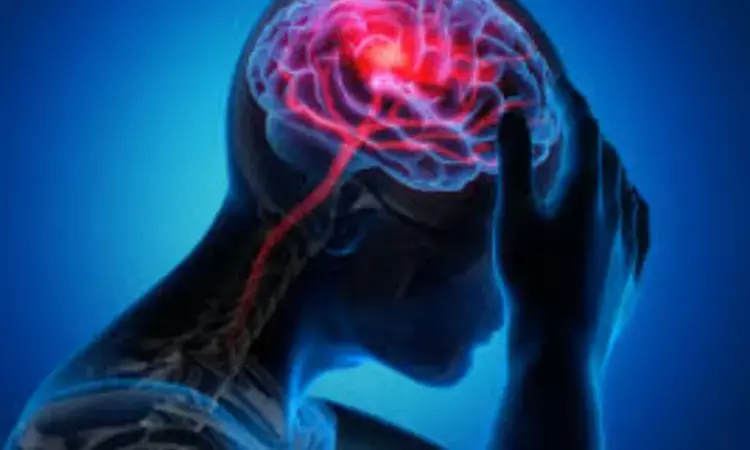 Transient Ischemic Attacks linked to long term Risk of Ischemic Strokes