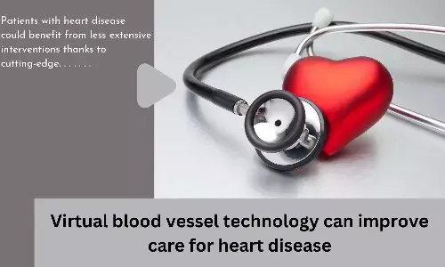 Virtual blood vessel technology can improve care for heart disease