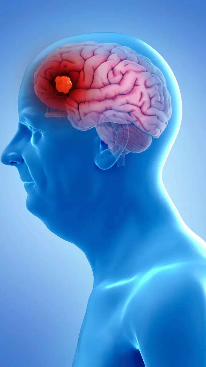 World Brain Tumour Day 2023