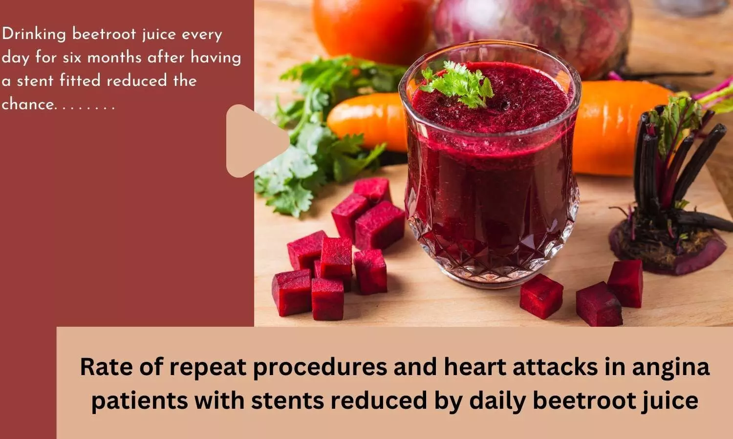 Rate of repeat procedures and heart attacks in angina patients with stents reduced by daily beetroot juice