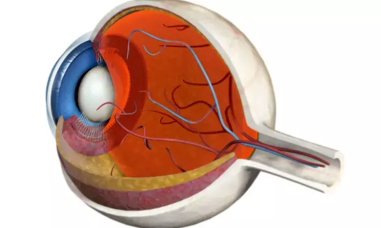Low peripapillary vascular density increases optic disc drusen volume